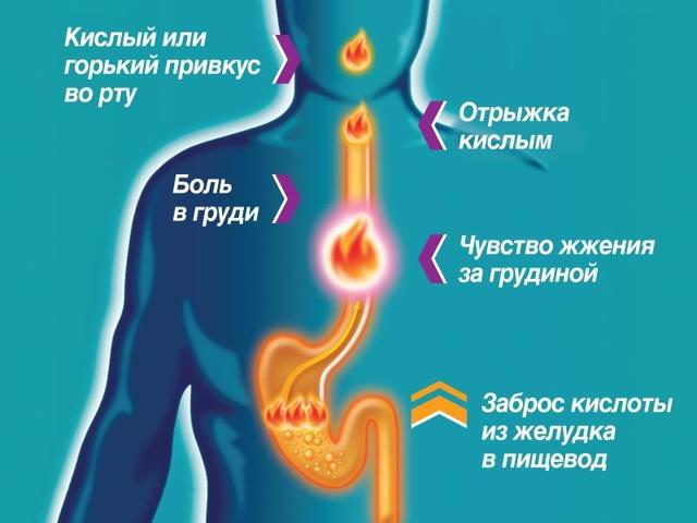 О Чем Говорит Боль в Грудной Клетке Посередине