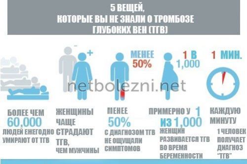 Тромб в ноге – причины, симптомы и лечение