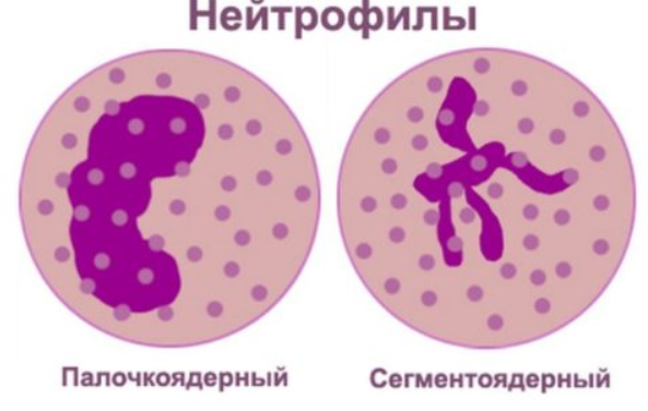 Нейтрофилы в крови повышены у взрослого, о чем это говорит