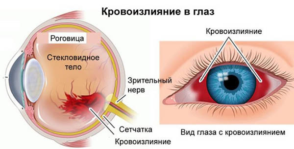 Как улучшить кровоснабжение глаза. Глаз, кровообращение в сосудах
