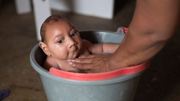 Вирус Зика - причины, симптомы и лечение Zika virus
