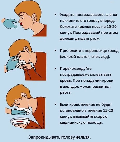 Кровь из носа: причины у взрослого и методы лечения дома