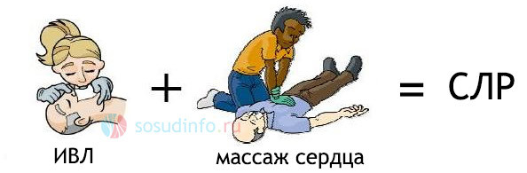 Искусственный массаж сердца и искусственное дыхание: техника проведения, правила и последовательность