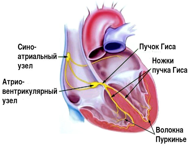 Неполная блокада правой ножки пучка Гиса - ЭКГ