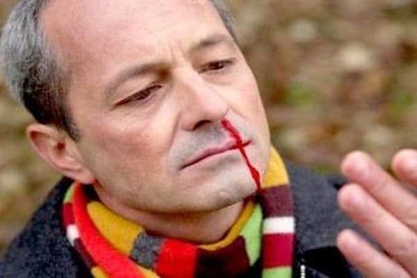 Болит голова и идет кровь из носа