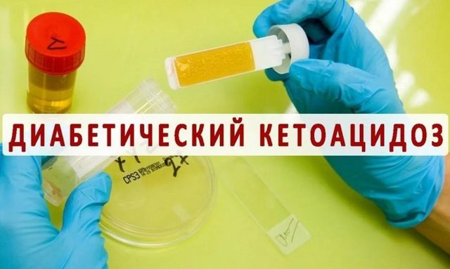 Диабетический кетоацидоз: что это такое, лечение, помощь при коме