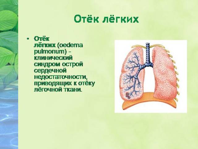 ПОЛЕЗНАЯ ИНФОРМАЦИЯ — Аневризма Вены Галена