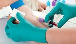 Анализ крови на mch и mchc