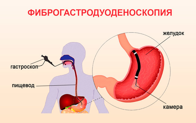 Что делать, если беспокоит жжение в области сердца