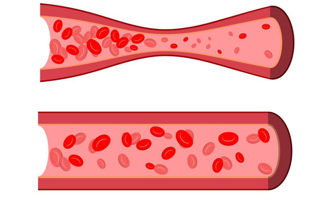 Ангиография (МРА) головного мозга. Личный опыт