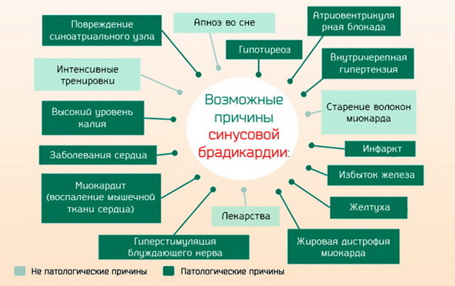 Как повысить пульс при брадикардии?
