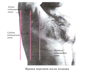 Топография грудной клетки. Границы грудной клетки
