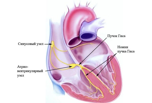 ЭКГ при блокаде правой ножки пучка Гиса (ПНПГ)