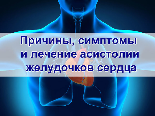 Асистолия сердца - что это такое, симптомы