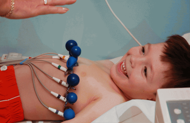 Регулярный и нерегулярный синусовый ритм сердца