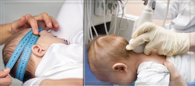 Внутричерепное давление – причины, симптомы и признаки (у взрослого, у ребенка), диагностика, методы лечения. Как измерить? Как снизить повышенное внутричерепное давление?