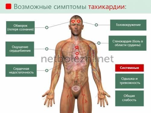 Какие лекарства пить при тахикардии