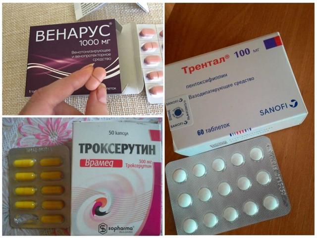 Отеки при варикозе - снимаем быстро и надолго