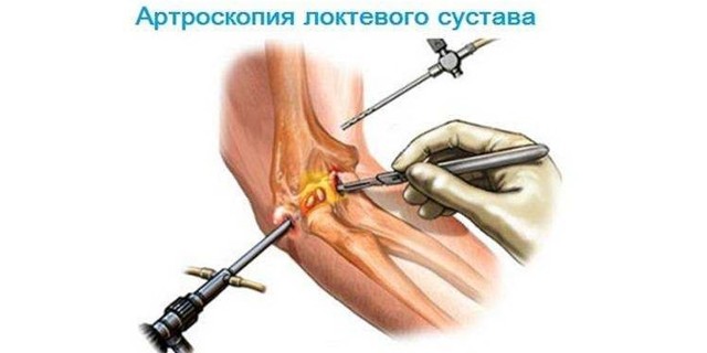 Боль в локтевом суставе: причины, лечение и профилактика