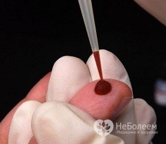 Онкомаркеры - что это такое, расшифровка и норма