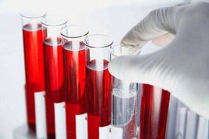 Что входит в биохимический анализ крови – определение главных показателей и норм