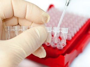 Экстрасистолы после рча - Все про гипертонию