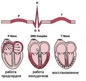 Регулярный и нерегулярный синусовый ритм сердца