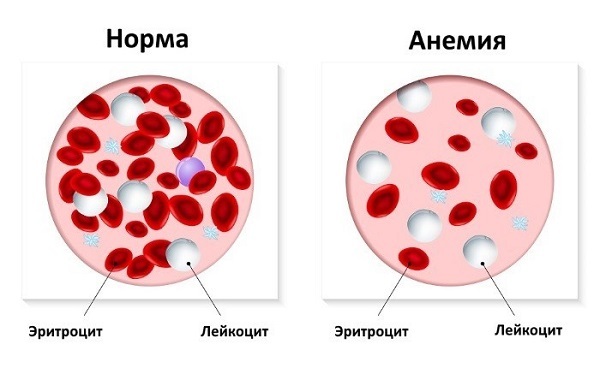 Какие продукты повышают гемоглобин в крови?