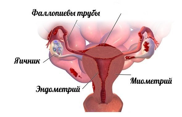Месячные идут со сгустками крови и кусками — причины