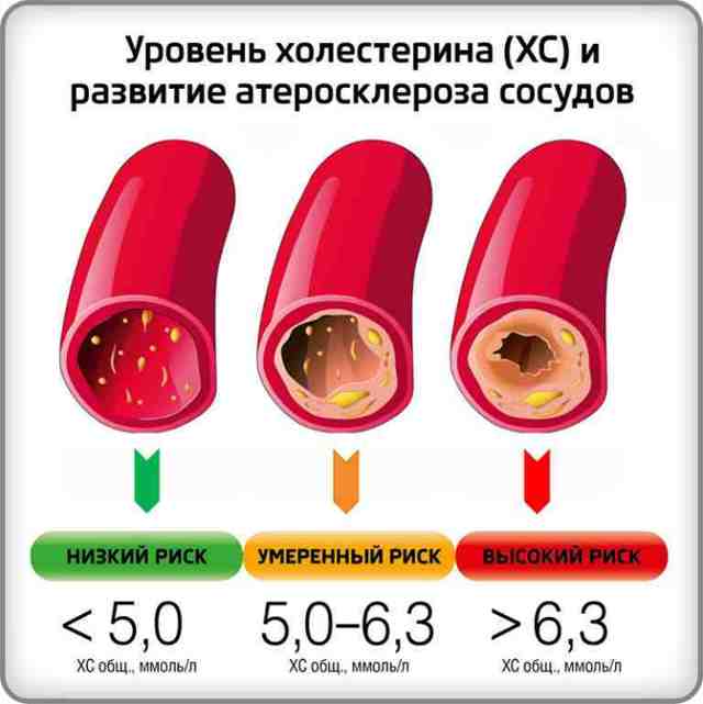 Какая норма холестерина в крови у женщин и мужчин по возрасту