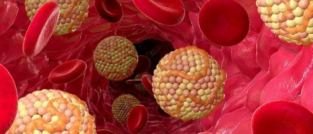 Снижение холестерина: как снизить повышенный холестерин в крови