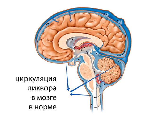 Симптомы и лечение повышенного внутричерепного давления