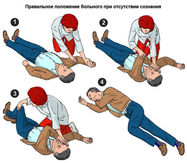 Первая помощь при инфаркте миокарда – что делать