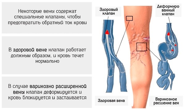 Индовазин мазь: инструкция, аналоги, показания к применению