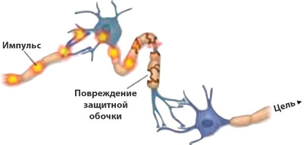 Мазь при полинейропатии нижних конечностей: классификация, медикаменты, народные средства, проявления