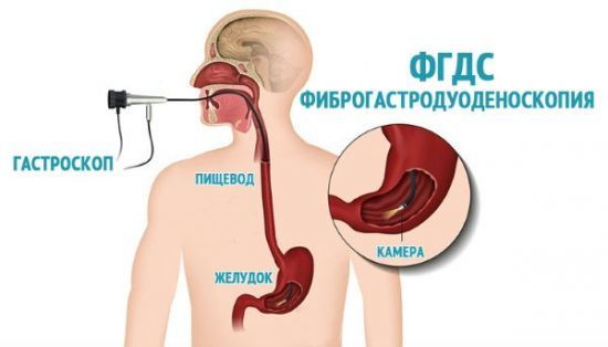 Гиперемирована слизистая желудка: что это значит, причины, лечение. Зев гиперемирован что значит