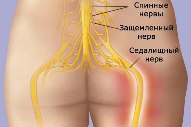 Болят ноги при сахарном диабете - причины, что делать