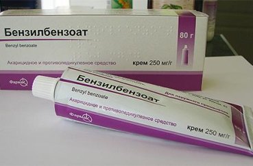 Вши у ребенка - чем лечить педикулез у детей: препараты, откуда берутся гниды и чем их выводить