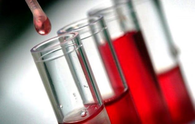 Анализ крови на билирубин - что это такое, как обозначается