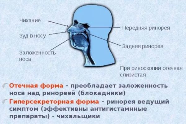 Аминокапроновая кислота - 3 отзыва, инструкция по применению