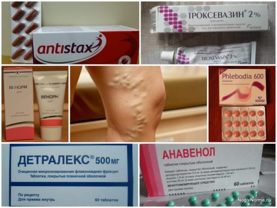 Венотоники при варикозе ног - гель, уколы, отзывы