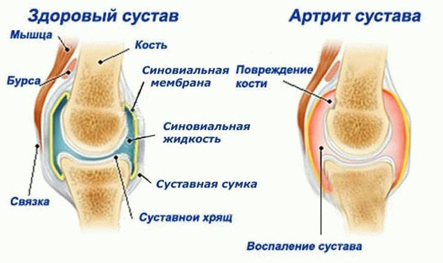 Показания к использованию Випросал мазь - побочные действия