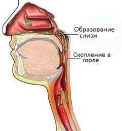 Постоянное отхаркивание слизи – причины и лечение