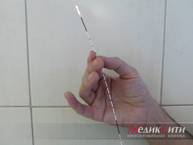 Сколько стоит лазерная операция варикоза на сайте варикоз