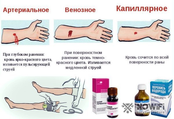 Кровоостанавливающие препараты