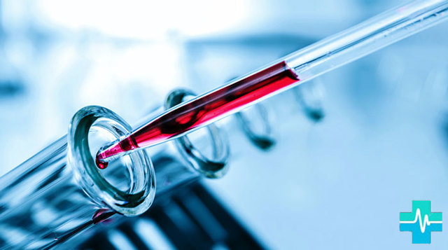 На что влияет повышенный билирубин в крови. Повышенный билирубин в крови: причины, симптомы и способы понижения