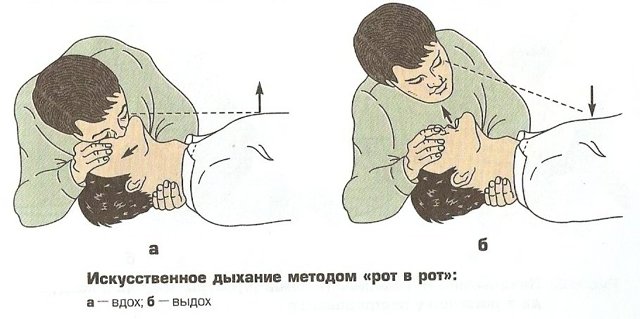 Восстановление сердечной деятельности. Способы восстановления сердечной деятельности. Непрямой массаж сердца. Механизм наружного массажа сердца. Как выполнять непрямой массаж сердца?