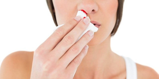 Как остановить носовое кровотечение - Лечение кровотечений