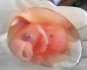 Кровянистые выделения на ранних сроках беременности