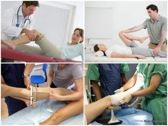 Послеоперационный период при операции на венах ног